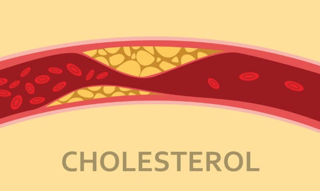 Cholesterol là gì? Trans là gì - ảnh 9
